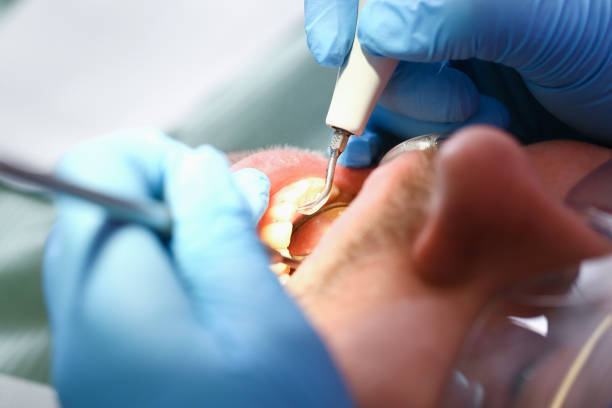 Best Pediatric Emergency Dentist in Laurel Park, NC